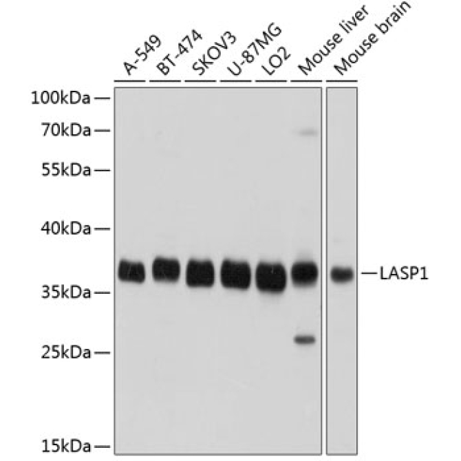 LASP1 Rabbit Polyclonal Antibody