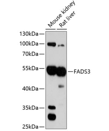 FADS3 Rabbit Polyclonal Antibody