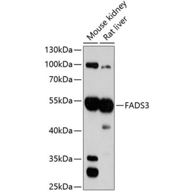 FADS3 Rabbit Polyclonal Antibody