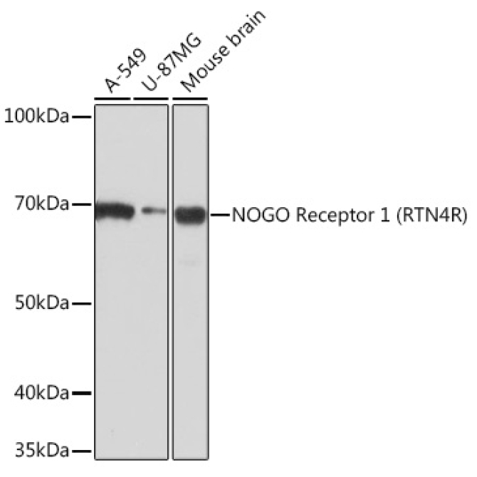 NOGO Receptor 1 (RTN4R) Rabbit Monoclonal Antibody