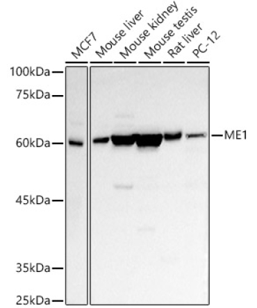 ME1 Rabbit Polyclonal Antibody