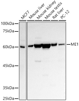ME1 Rabbit Polyclonal Antibody