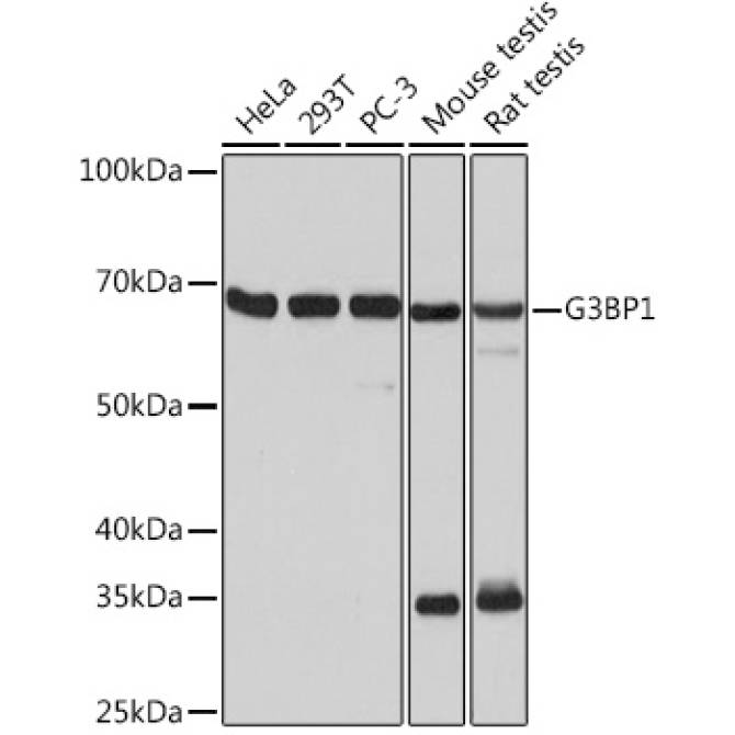 G3BP1 Rabbit Monoclonal Antibody