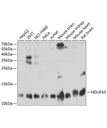 NDUFA5 Rabbit Polyclonal Antibody