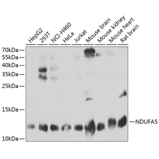 NDUFA5 Rabbit Polyclonal Antibody
