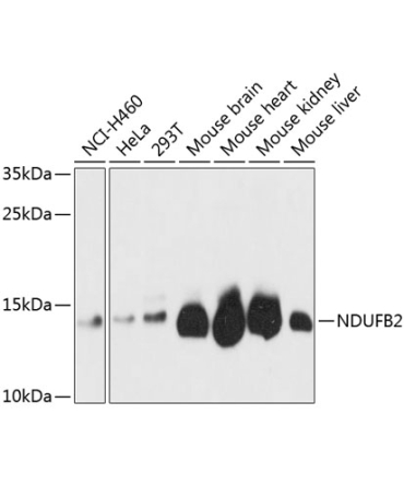 NDUFB2 Rabbit Polyclonal Antibody