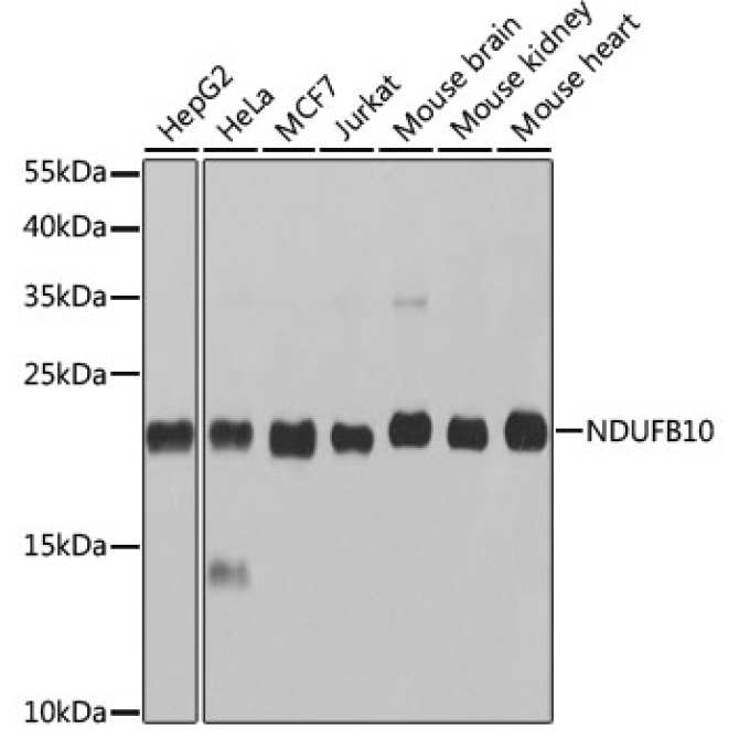 NDUFB10 Rabbit Polyclonal Antibody