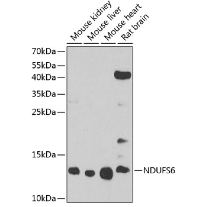 NDUFS6 Rabbit Polyclonal Antibody