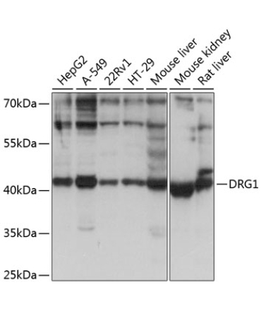 DRG1 Rabbit Polyclonal Antibody