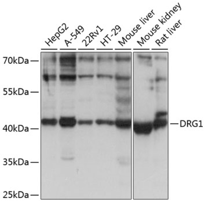 DRG1 Rabbit Polyclonal Antibody