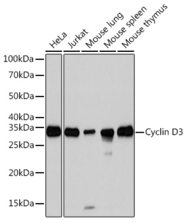 Cyclin D3 Rabbit Monoclonal Antibody