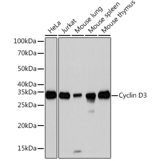 Cyclin D3 Rabbit Monoclonal Antibody