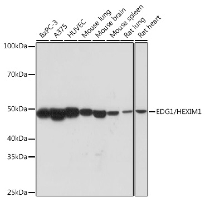 EDG1/HEXIM1 Rabbit Monoclonal Antibody
