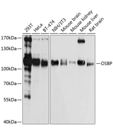 OSBP Rabbit Polyclonal Antibody
