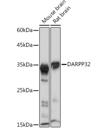 DARPP32 Rabbit Monoclonal Antibody