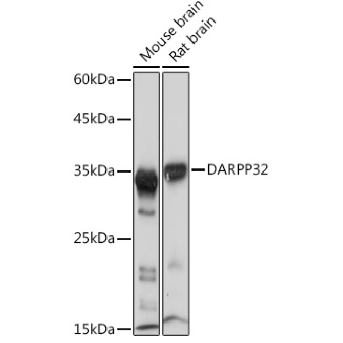 DARPP32 Rabbit Monoclonal Antibody