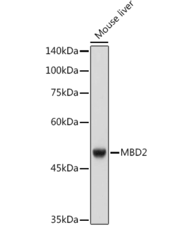 MBD2 Rabbit Monoclonal Antibody