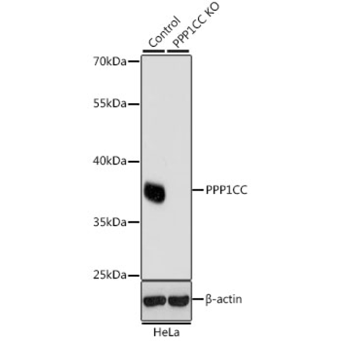 PPP1CC Rabbit Polyclonal Antibody [KO Validated]