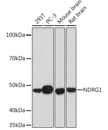 NDRG1 Rabbit Monoclonal Antibody