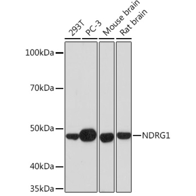 NDRG1 Rabbit Monoclonal Antibody