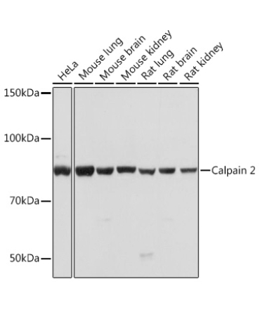 Calpain 2 Rabbit Monoclonal Antibody