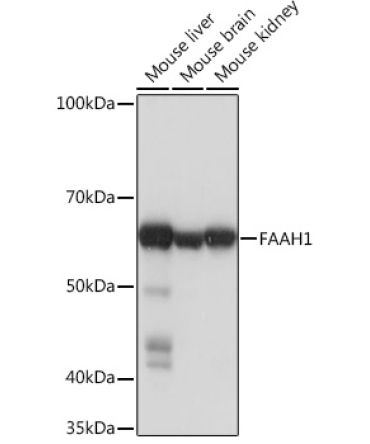 FAAH1 Rabbit Monoclonal Antibody