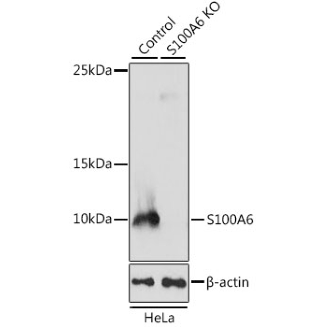 S100A6 Rabbit Polyclonal Antibody [KO Validated]