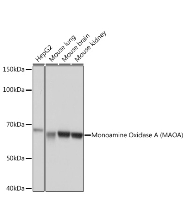 Monoamine Oxidase A (MAOA) Rabbit Monoclonal Antibody