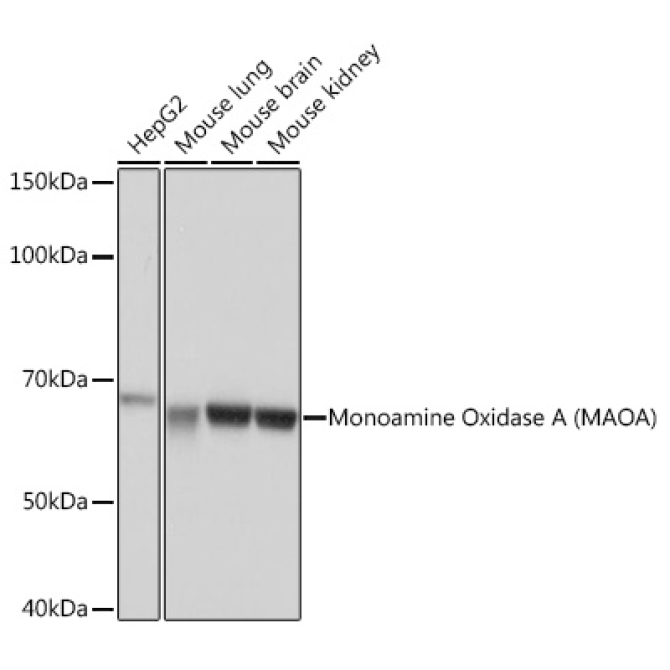 Monoamine Oxidase A (MAOA) Rabbit Monoclonal Antibody