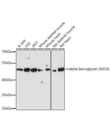 alpha Sarcoglycan (SGCA) Rabbit Polyclonal Antibody