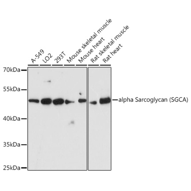 alpha Sarcoglycan (SGCA) Rabbit Polyclonal Antibody