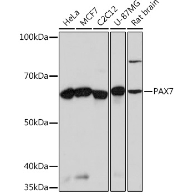 PAX7 Rabbit Monoclonal Antibody