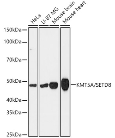 KMT5A/SETD8 Rabbit Monoclonal Antibody [KD Validated]