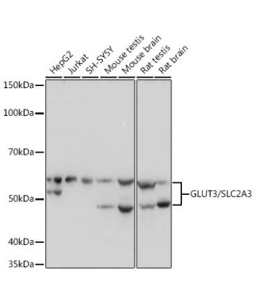 GLUT3/SLC2A3 Rabbit Monoclonal Antibody
