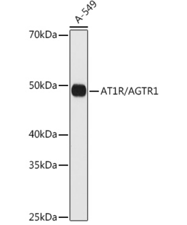 AT1R/AGTR1 Rabbit Monoclonal Antibody