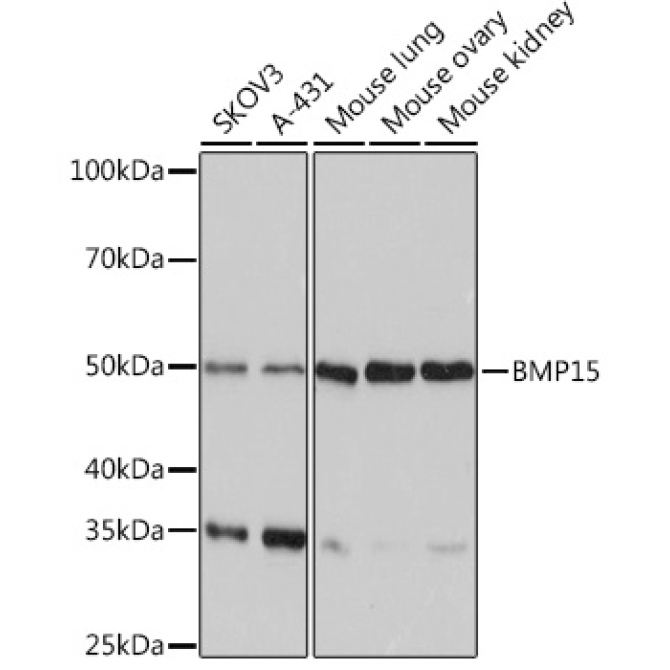 BMP15 Rabbit Monoclonal Antibody