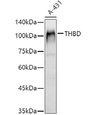 CD141/Thrombomodulin Rabbit Polyclonal Antibody