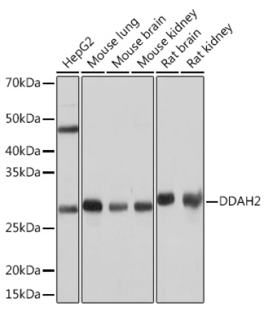 DDAH2 Rabbit Monoclonal Antibody
