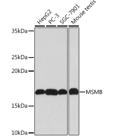 MSMB Rabbit Monoclonal Antibody