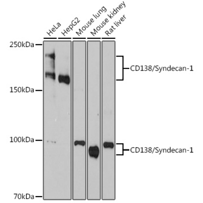 CD138/Syndecan-1 Rabbit Monoclonal Antibody