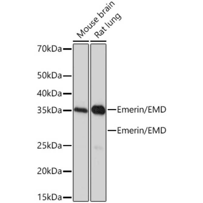 Emerin/EMD Rabbit Monoclonal Antibody