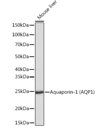 Aquaporin-1 (AQP1) Rabbit Monoclonal Antibody