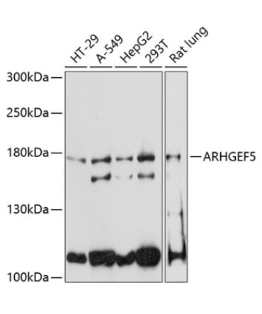 ARHGEF5 Rabbit Polyclonal Antibody
