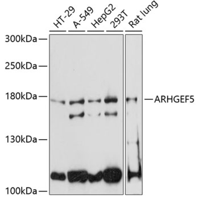 ARHGEF5 Rabbit Polyclonal Antibody