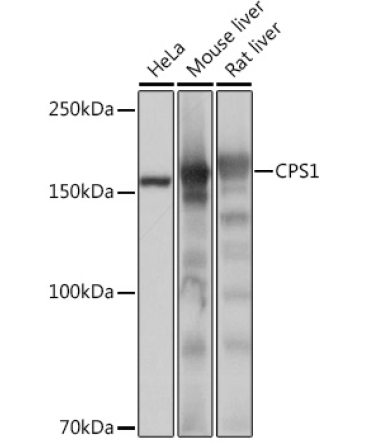 CPS1 Rabbit Monoclonal Antibody