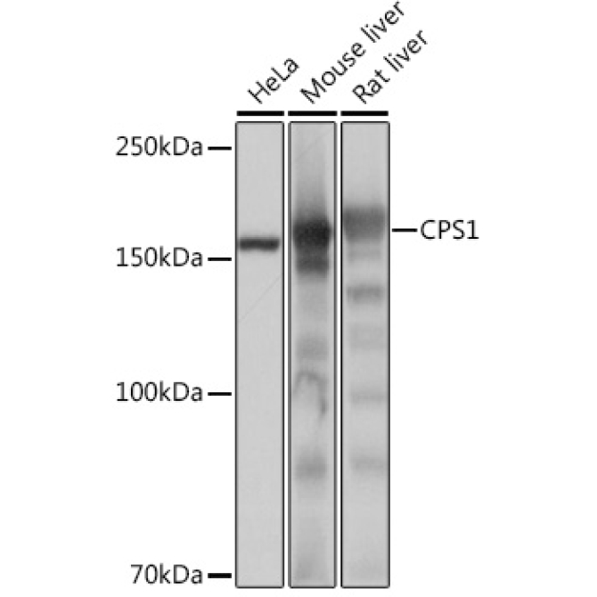 CPS1 Rabbit Monoclonal Antibody