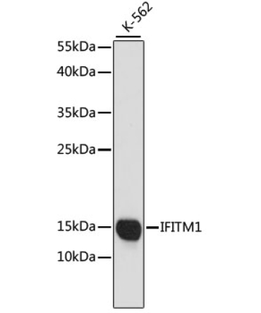 CD225/IFITM1 Rabbit Polyclonal Antibody
