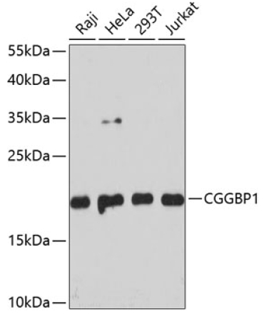 CGGBP1 Rabbit Polyclonal Antibody