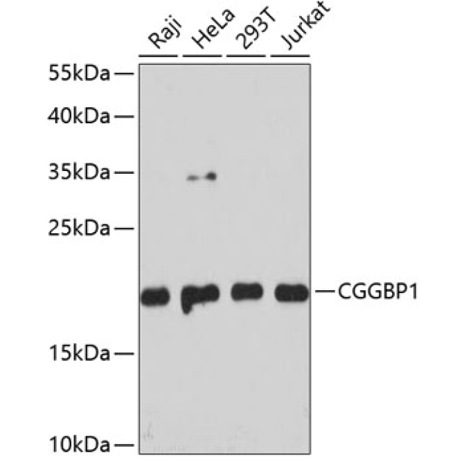 CGGBP1 Rabbit Polyclonal Antibody