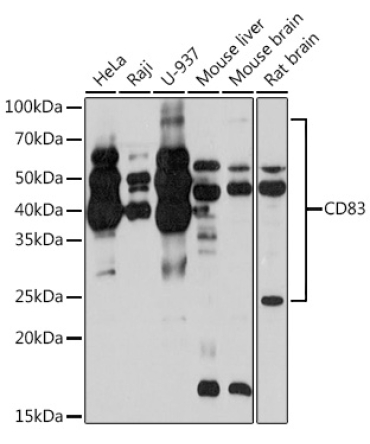 CD83 Rabbit Monoclonal Antibody